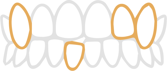 gatagata