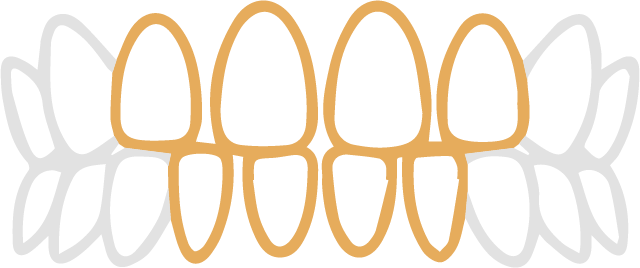 sukippa