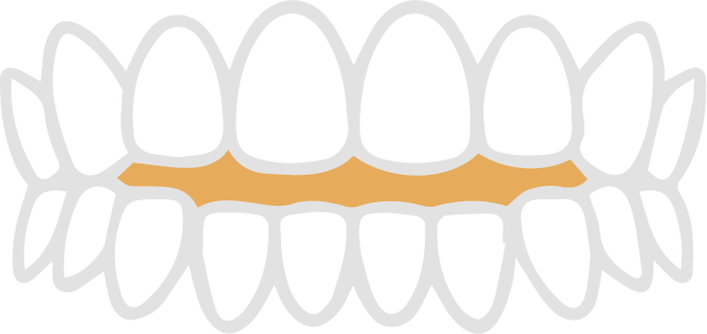 tojinai