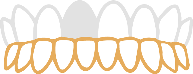 ukeguchi